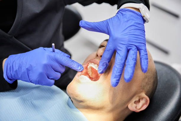 Best Chipped Tooth Repair Near Me  in Huron, CA